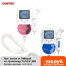 Contec doppler fetal coração batida monitor retroiluminação lcd cor rosa + gel livre 2mhz 3mhz 8mhz sonda bebê coração batida monitor sonda