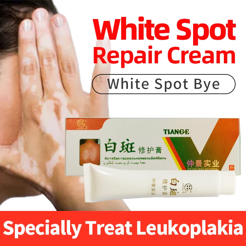 white spot removal cream