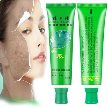 

30g Face Skin Care Acne Cream Oil Control Acne Products Face Cream beauty Not Hurt the Skin
