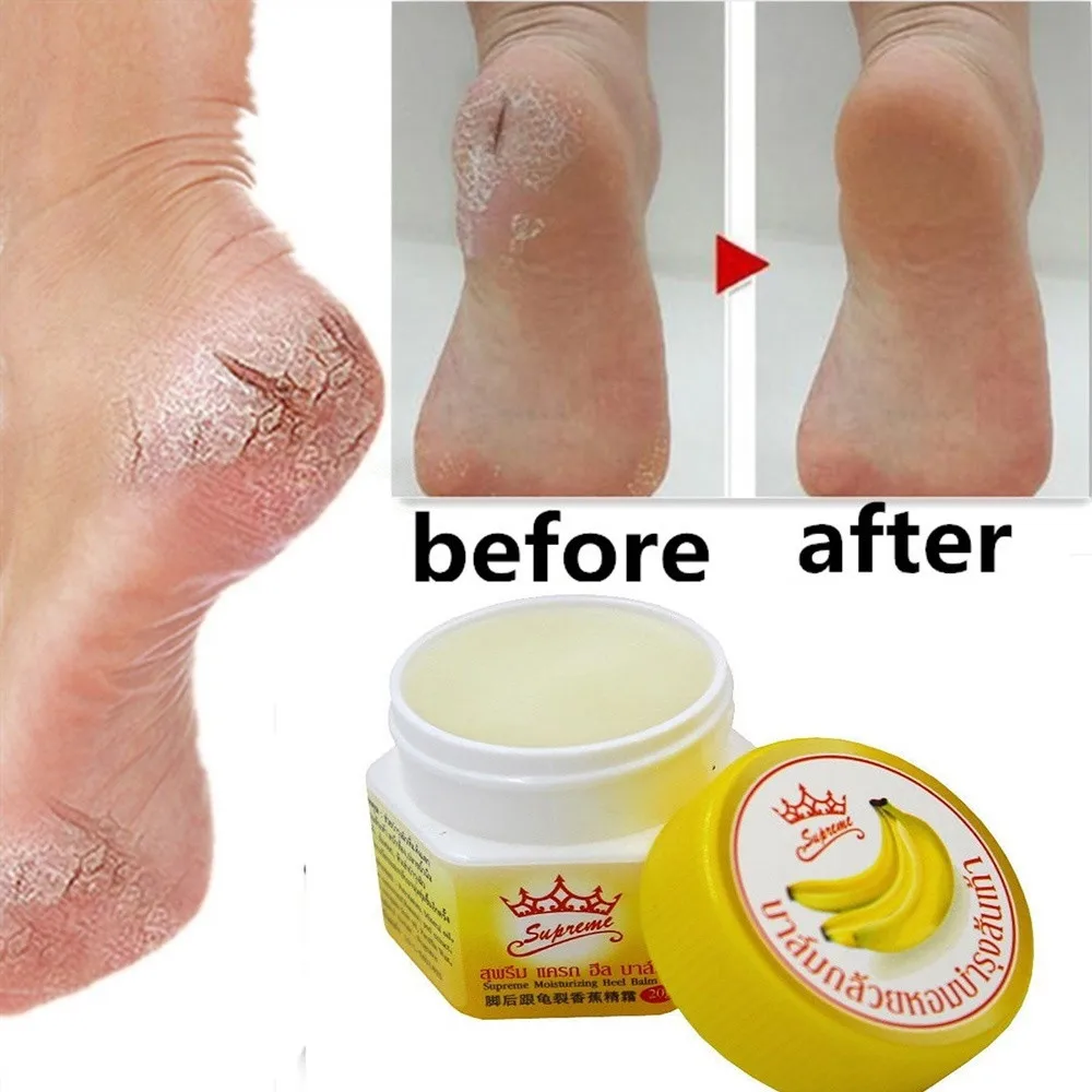 Рука ноги пятки питают против грибков против обветренного запаха лечение банановое масло ремонт анти-сушка трещина