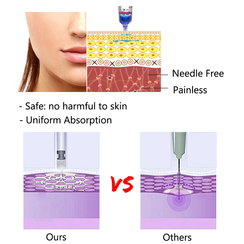 Профессиональный неинвазивный ингалятор инъекции Ручка удаления шрамов уменьшить морщины Растяжки подтяжки кожи микро крошечные иглы