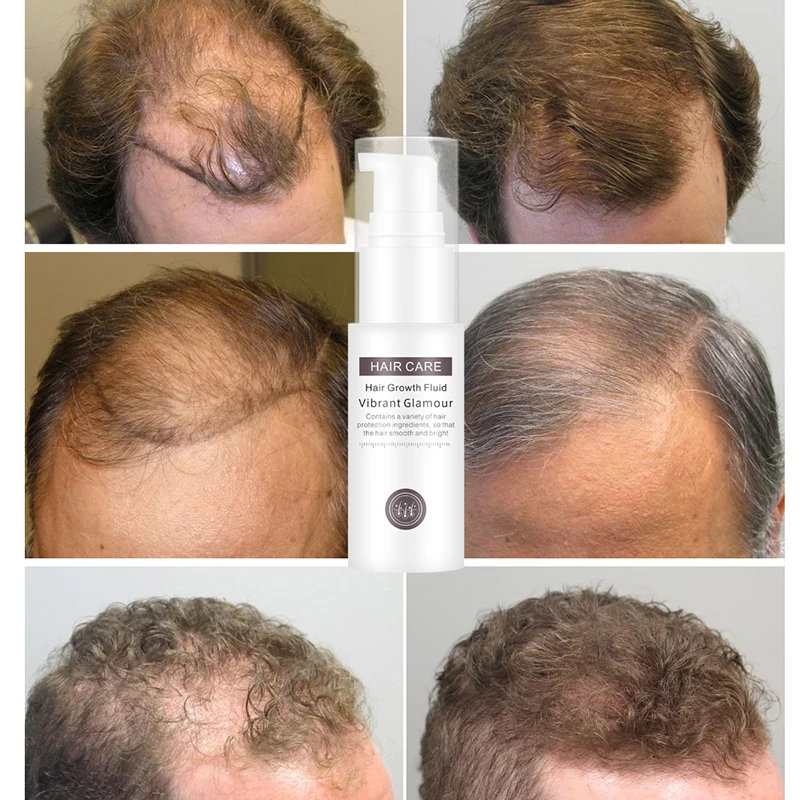 30ML Haid Growth Fluid Nourish Hair Roots Thick Repair Hair Thick And Shiny Soothing Scalp