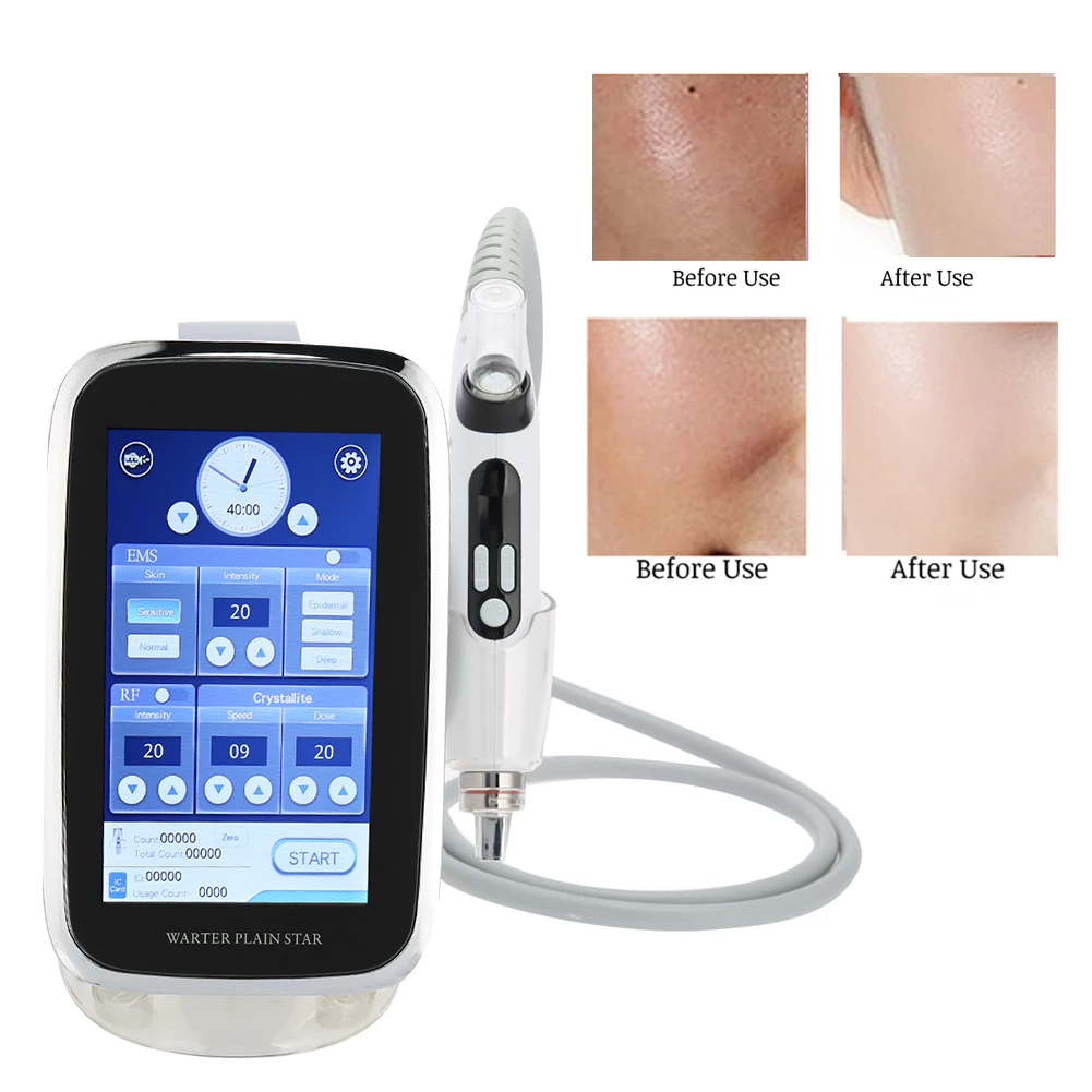 RF+EMS Nano Microcrystalline No Needle Water Gun Non-invasive Hydrating Beauty Instrument blossoming beauty hydrating