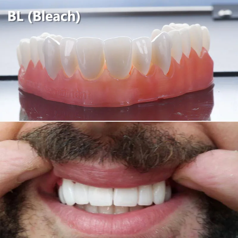 UT extreme 5 шт. 201519 мм sirona/ Cerec эстетика Многослойные ультрапрозрачные высокопрочные