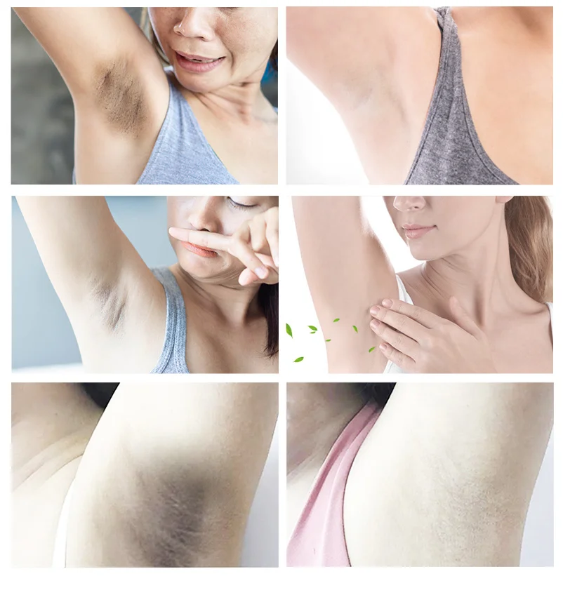 Yoxier Deodorant Spray Body Odor Dew Sweat Deodor Perfume Spray Unisex Armpit Odor Underarm Odor Remover Skin Care Product 20 ml