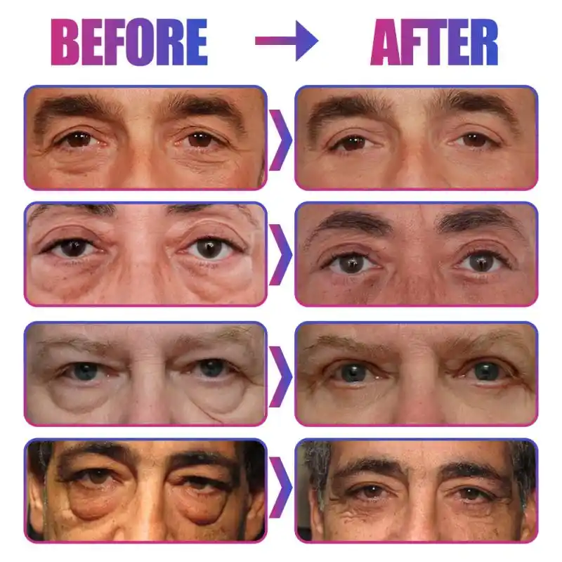 men's wrinkle remover