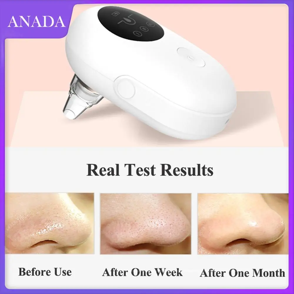 

Anada Blackhead Remover Face Deep Pore Cleaner Acne pimple Removal Vacuum Machine Facial Portable Beauty Skin Care Tool