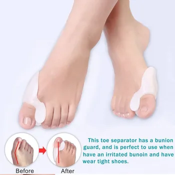

7PCS/SET Bunion Sleeves Hallux Valgus Corrector Alignment Toe Separator Metatarsal Splint Orthotics Pain Relief Foot brace