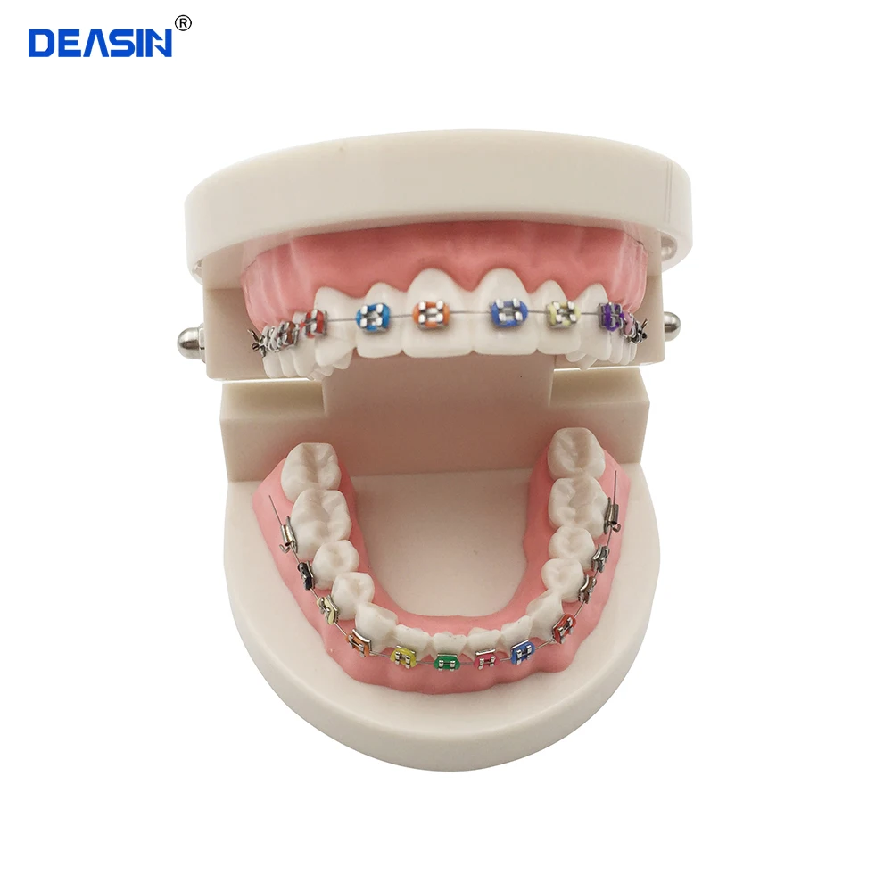 

Dental Orthodontic Treatment Model With Ortho Metal Ceramic Bracket Arch Wire Buccal Tube Ligature Ties Dentist Tools Lab