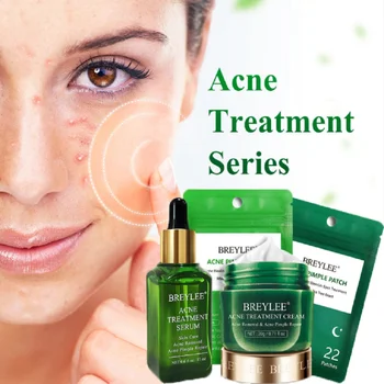 

BREYLEE AcnePimple Patch Acne Treatment Serum Acne Cream Pimple Remover Tool Skin Care Face Cream Facial Serum Essence face Mask