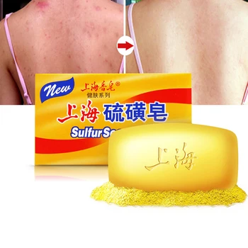 

85g/125g Anti Fungus 4 Skin Conditions Seborrhea Eczema Perfume Butter Bubble Bath 85g Shanghai Sulfur Soap Acne Psoriasis