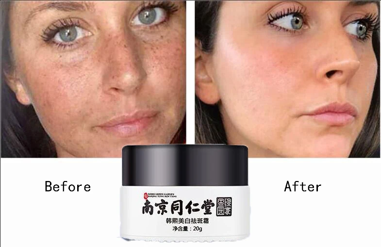 

Whitening Facial Cream Repair Fade Freckles Remove Dark Spots Melanin Remover Brightening Face Cream