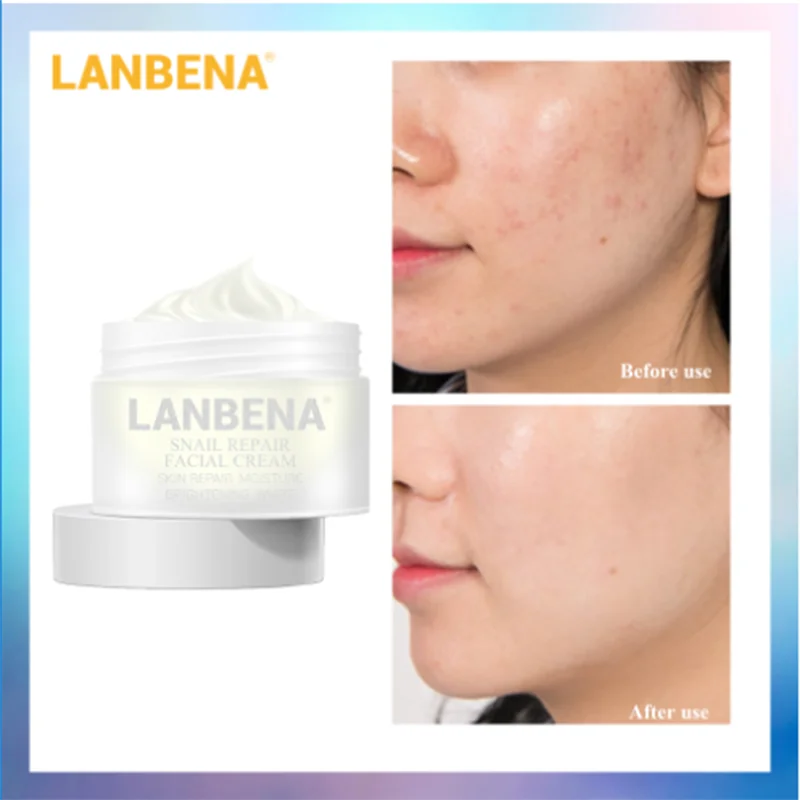 LANBENA Snail Repair крем для лица отбеливающий увлажняющий дневной крем против старения лечение акне против морщин укрепляющий уход за кожей 30 г