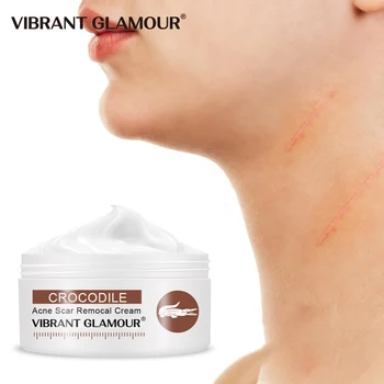 

1pc Crocodile Repair Scar Face Cream Anti-Wrinkle Aging Moisturizing Face Care Whitening Oil-Control Shrink Pores Skin Care