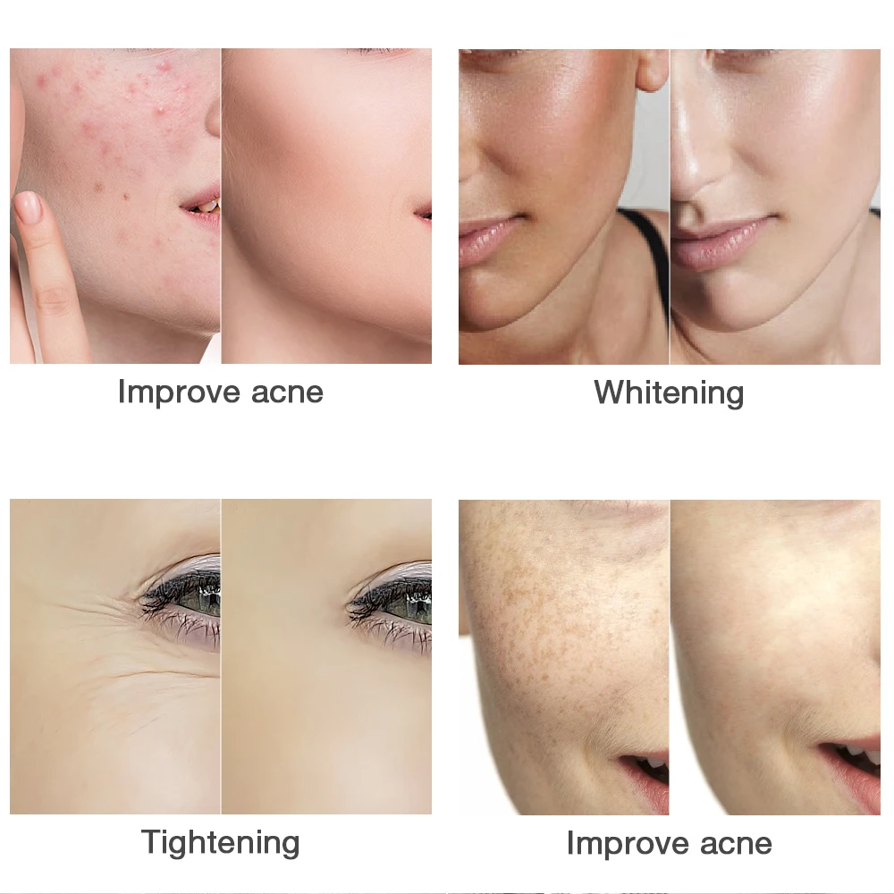 Anti-envelhecimento da Pele Cuidados com a Pele Uso sem Fio Cores Fóton Terapia Máscara Facial Clarear Melanina Clareamento Apertar Fotônico 3 Led Luz 11 High Quality Beleza e saúde