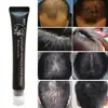 Hair Line Growth Serum Derma Scalp Hair Loss Triple Massager Roll Regrow Essence 20ml Ampoule Fast Hair 1