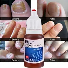 Золы для ногтей специальная жидкость Антибактериальная жидкость для роста жидкий крем для зачистки мягкий крем для ногтей жидкая серая паста для ногтей
