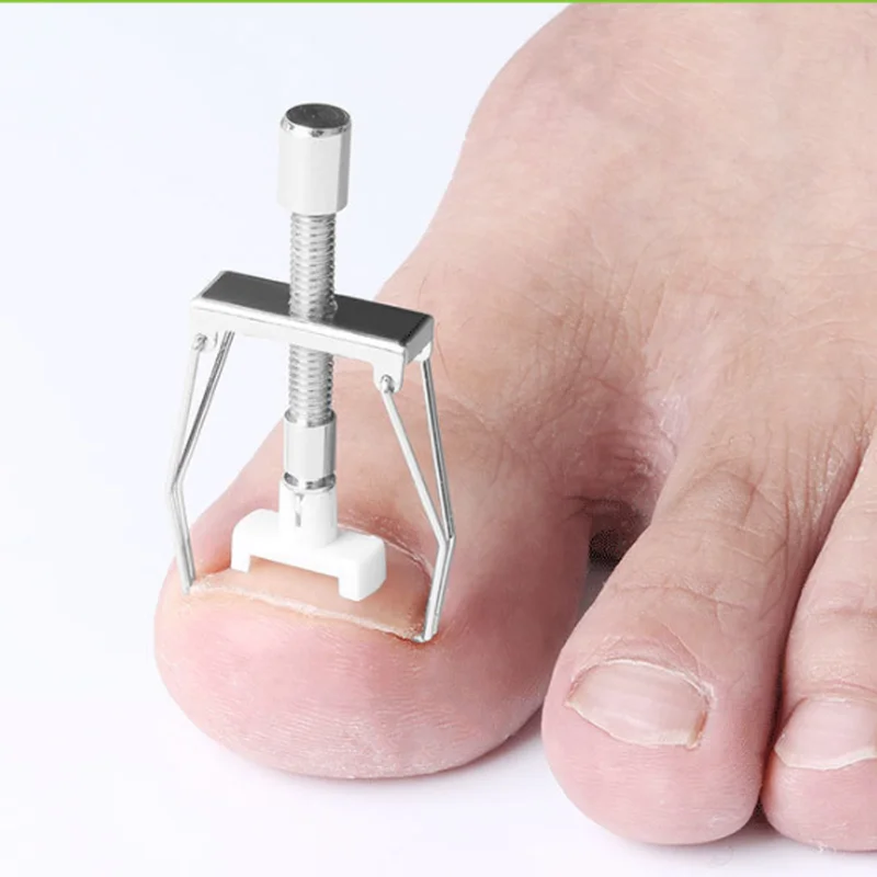 Ingrown Toe Nail Recover Correction Tool Pedicure Toenail Fixer Foot Nail Care Tool Orthotic Nail Corrector Pedicure Tool XYR