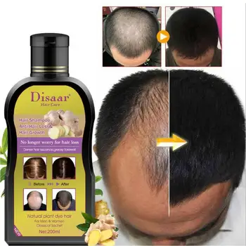 

200ml Disaar Professional Anti-hair Loss Shampoo Preventing Hair Loss Chinese Hair Growth Product Hair Treatment For Men Women