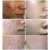 Лечение Акне Сыворотка Для Лица Centella Asiatica Oil Control Shrink Pores Scar Essence Отбеливающий Увлажняющий Крем Уход За Кожей MeiYanQiong