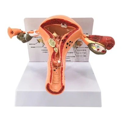 Uterus Ovary Anatomical Model Vagina Genitourinary Model Gynecological Reproductive Teaching Aids Tool Size : 16x20cm