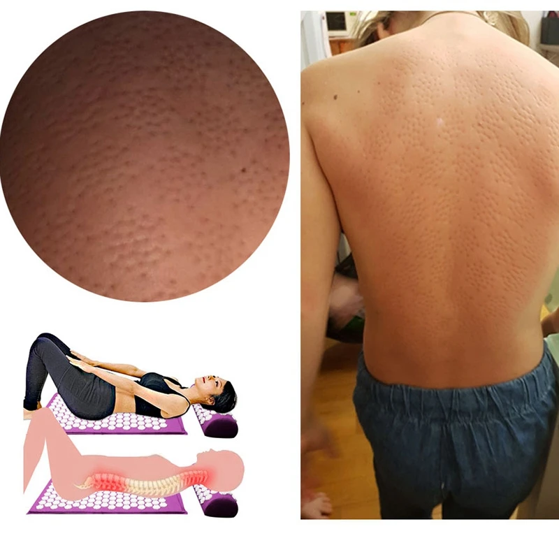 Массажный коврик Lotus Acupressure подушка шиацу Облегчает боль Стресс Массаж тела способствует циркуляции крови коврик для акупунктуры
