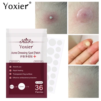 

36pcs/sheet Skin Tag Remover Pimple Master Patch Treatment Invisible Acne Stickers Patch Skin Acne Concealer Tags Makeup Tools