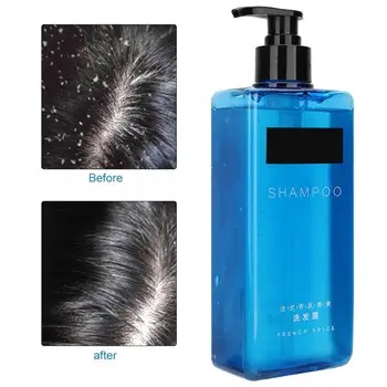 

Shampoo 400ml Men Hair Shampoo Oil Control Moisturizing Long Lasting Fragrance Hair Repairing Shampoo Hair Growth Shampoo