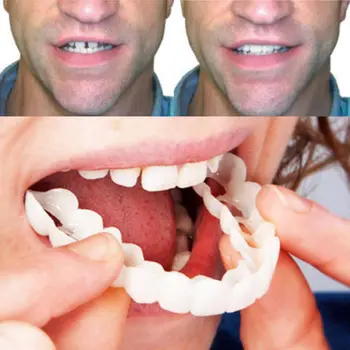

Denture stick temporary repair broken tooth tool Tooth whitening products