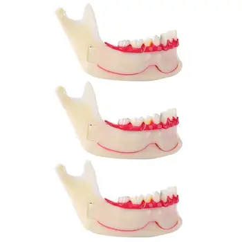 

Plastic Lower Jaw Mandible Model for Dental Teeth Pathology Teaching Tool Dentists and Patients Communication Model