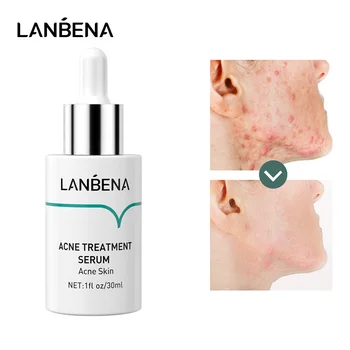 

LANBENA Acne Treatment Serum opeptide Anti Acne Reduce Mark Shrink Pores Deep Repair Strengthen Skin Bottom 30ML