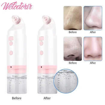 

Facial Bubble Vacuum Suction With Water Cycle Deep Pore Cleaning Blackhead Ance Removal Oil Skin Care Oxygen Facial Care Tools