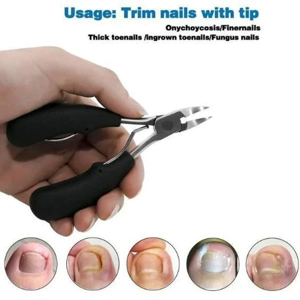 Toenail Clippers, Medical Grade Toe Nail Trimmer, Nail Clippers