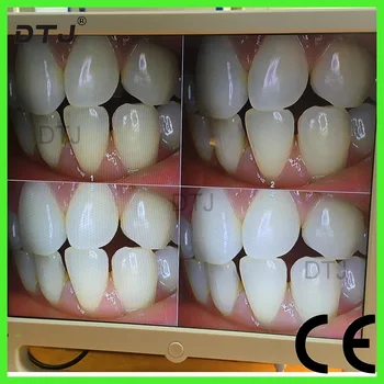 

DTJ odontologia 17 inch 100000000 pixel all in one Dental Oral camera LCD monitor Teeth Whiten Camera
