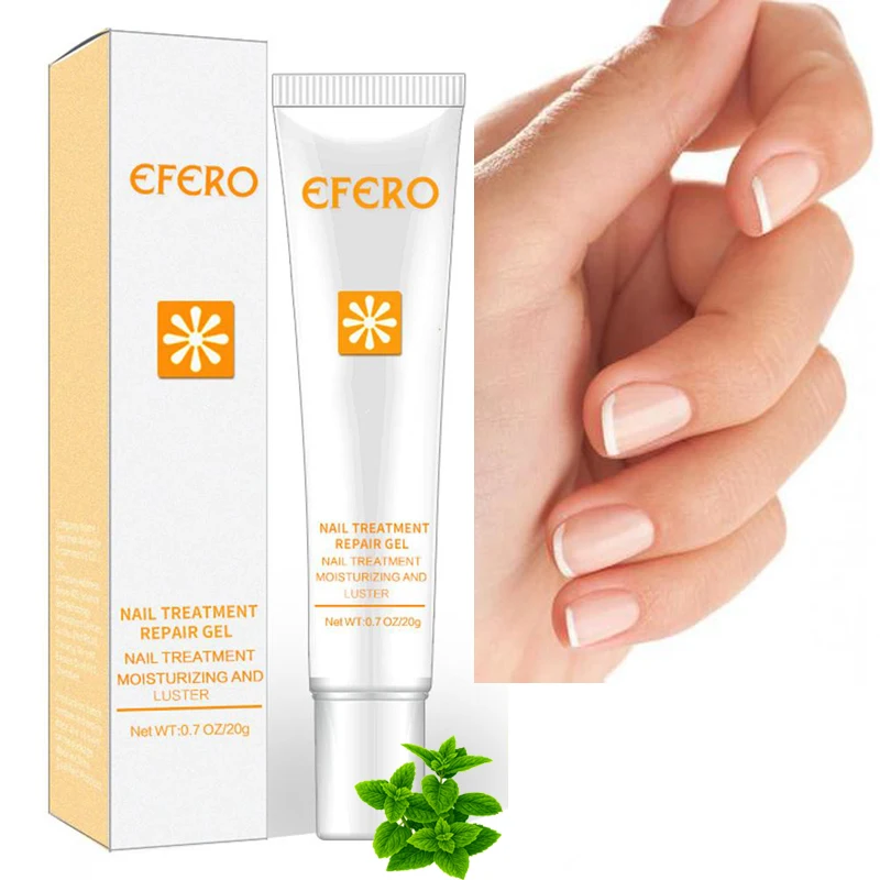 Nail Treatment Repair Cream Chinese Herbal Skin Care Nail Fungus Nails Repair Onychomycosis Paronychia Anti Naturally Treatment