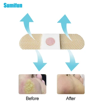 

24Pcs Foot Corn Removal Medical Plaster Calluses Plantar Warts Thorn Plaster Health Care For Relieving Pain Foot Care D2399