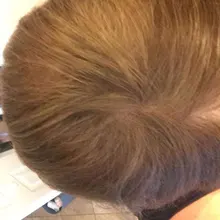 Cuidado del cabello para el crecimiento del cabello aceites esenciales esencia Original auténtico 100% pérdida de cabello líquido salud belleza suero denso para el crecimiento del cabello