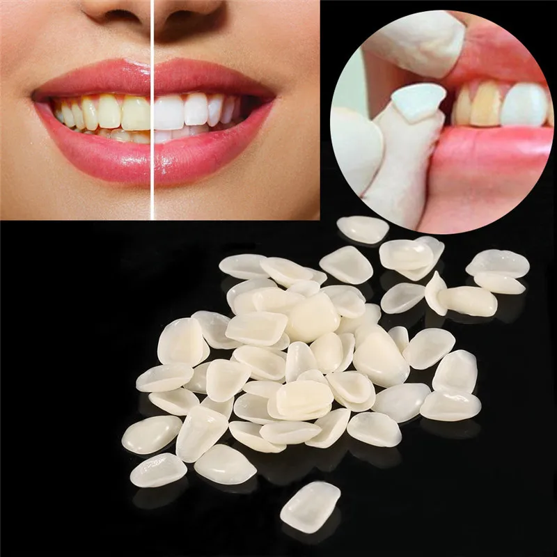 Couronne temporaire dentaire en résine ultra fine, blanchiment des dents,  ombre antérieure, placages dentaires de dentiste, 50 pièces - AliExpress