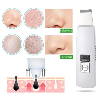 

DropShipping Portable Ultrasonic Skin Scrubber Face Cleanser Pore Wrinkle Remover Cleaner Face Lifting Skin Care Machine Devices