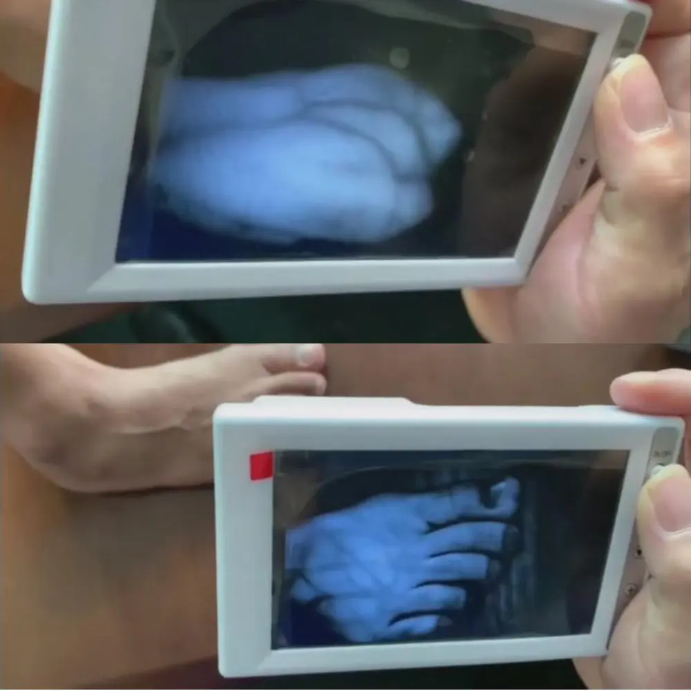 5 дюймов lcd HD экран Инфракрасный светильник вены зритель локатор Transilluminator