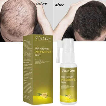 

New Fast Hair Growth Essential Oil 30ml Hair Loss Products Treatment Regrowth Ginger Serum Essence Hair Care for Women Men