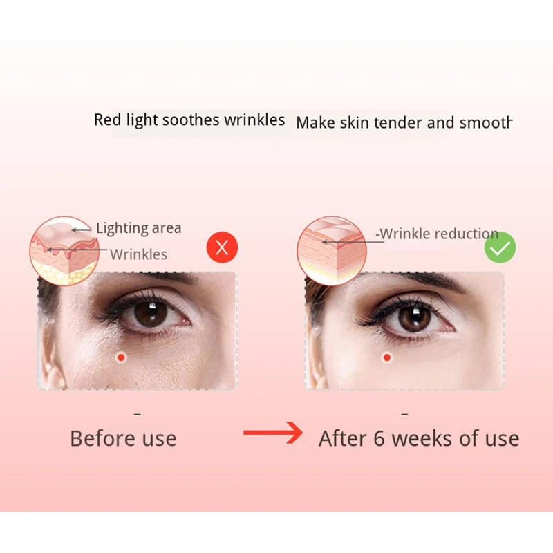  IPL Beauty Instrument Handheld LED Machine Photon Spectrometer Skin Rejuvenation Supplement Collage - 4000464772646