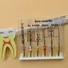 Стоматологический поворотный Супер Файлы superfiles Универсальная игла аксессуары endodontic для корневого канала Файлы очистки стоматолог применение ► Фото 2/6