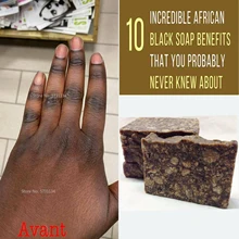 Natural 100% Raw African Black Soap  Magic Anti Taches Rebelles Beauty Bath Body Treatment Acne Skin