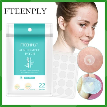

FTEENPLY Acne Pimple Patch Acne Treatment Invisible Sticker Remove Blemish Face Mask Beauty Skin Care Tool Cream Daily Use 22PCS