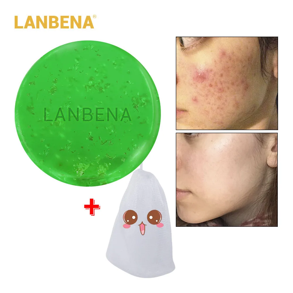 LANBENA Handmade Soap Tea Tree Essential Oil Facial Cleansing Acne Treatment Moisturizing Remover Anti-Aging Blackhead LANBENA Handmade Soap Tea Tree Essential Oil Facial Cleansing Acne Treatment Moisturizing Remover Anti-Aging Blackhead