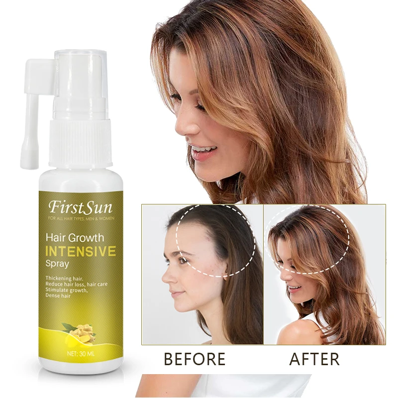 Extracto de Ginseng Natural en aerosol para el crecimiento del cabello, 30ml, estimula el refuerzo del cabello liso, esencia anticaída de cabello, TSLM2