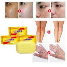 Растительная формула для противогрибкового дерматита кузацеа rhinoeczema псориаза и чесотки старого бренда Серного мыла в Китае