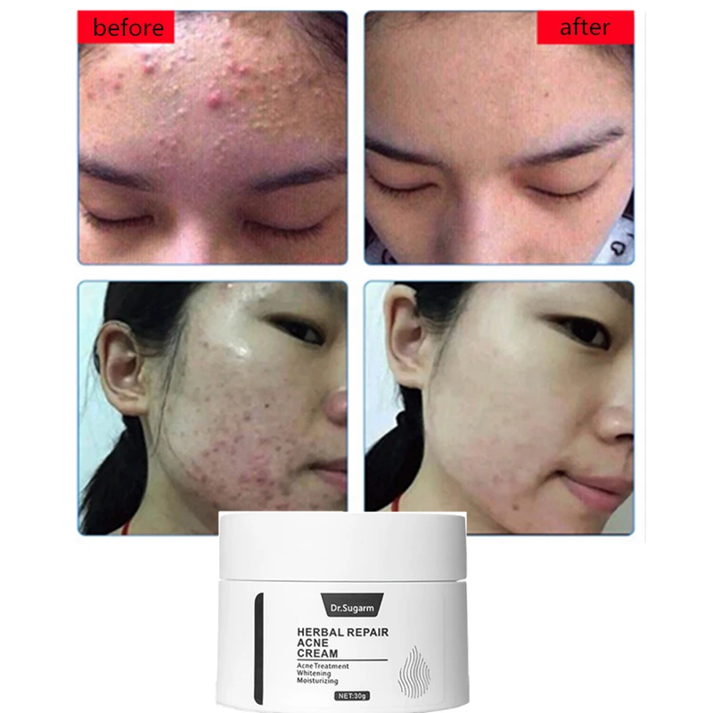 Dr Sugarm 2Pcs Hyaluronic Acid Serum Face Care Moisturizing Anti Aging Anti Wrinkle 1 Acne Repair 3
