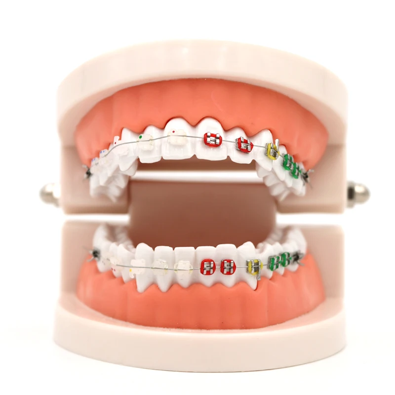 Dental Orthodontic Treatment Model With Ceramic Bracket Arch Wire Ortho